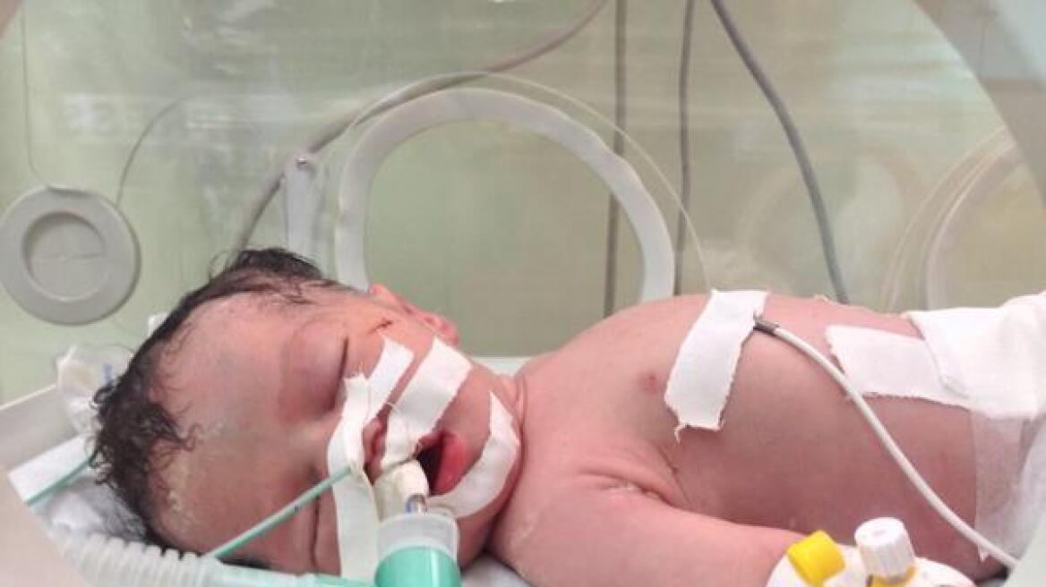 Γάζα: Πέθανε το μωρό-θαύμα που είχε γεννηθεί από νεκρή μητέρα